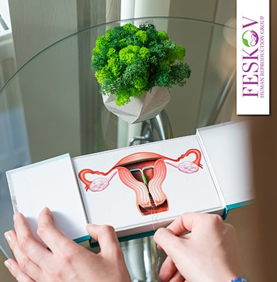 imsi icsi разница