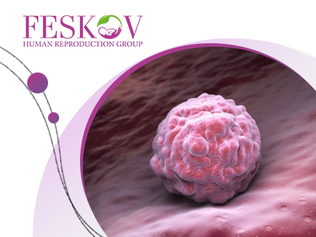 Подготовка эндометрия к переносу эмбрионов: как это работает